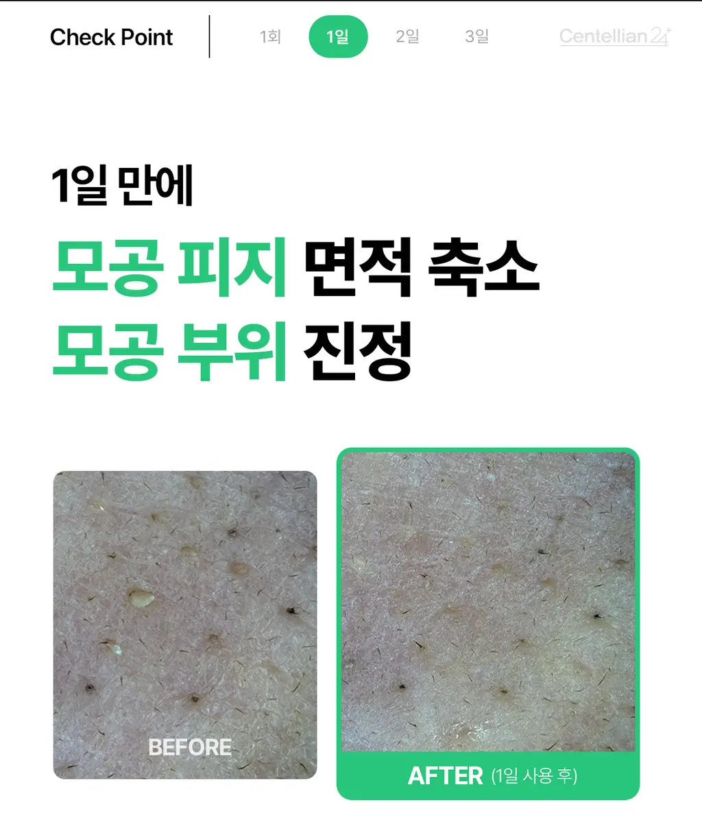 [1등 세럼/모공피지] 센텔리안24 마데카 분말 티트리 에이씨 6g 더블기획 푸린 에디션 (+푸린수면안대 포켓몬) 상세페이지 23
